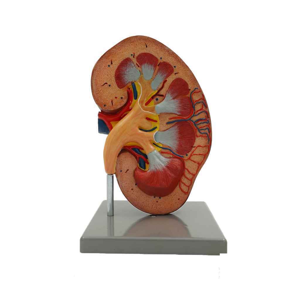 مولاژ کلیه ایستاده