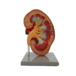 مولاژ کلیه ایستاده