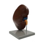 مولاژ کلیه ایستاده - تصویر 2